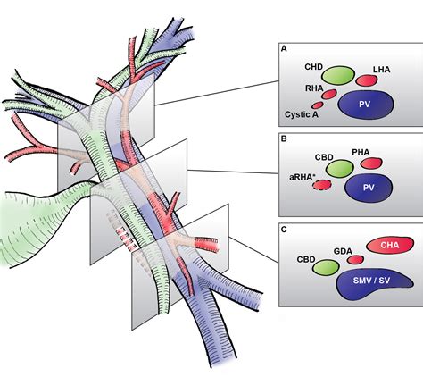 Mickey Mouse and the tubes connecting the liver – DataSurg