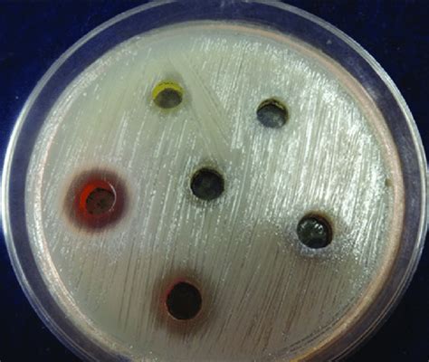Agar Disc Diffusion Method 的图像结果