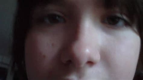 Image result for Exploding Elbow Pimple