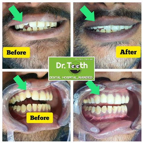 Dr.Teeth Dental & Cosmetic Surgery Expert , Nanded