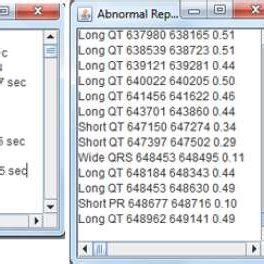Image result for Code Sinus Java