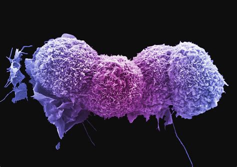 Cancer metabolism: finding how fast-growing cancers get their energy - Cancer Research UK ...
