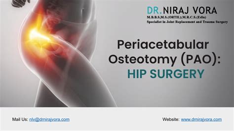 Periacetabular Osteotomy (PAO): Hip Surgery | Dr Niraj Vora by ...