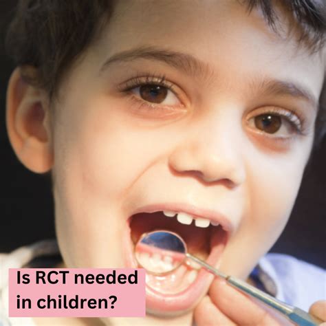 Common dental myths and facts - Shubham Dental Clinic