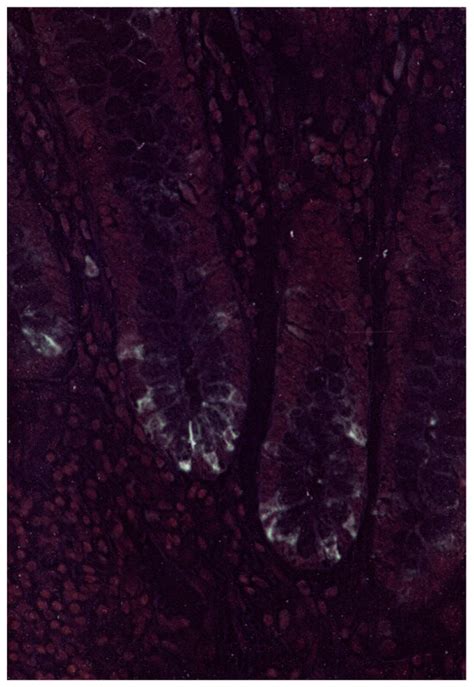 Gastrointestinal Disorders | An Open Access Journal from MDPI