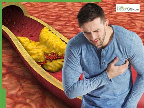 5 Warning Signs of Cardiac Arrest That May Appear A Month Before It ...