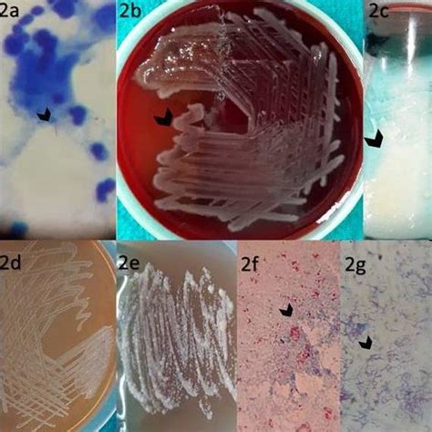 Image result for Acid-Fast Bacilli Staining Method