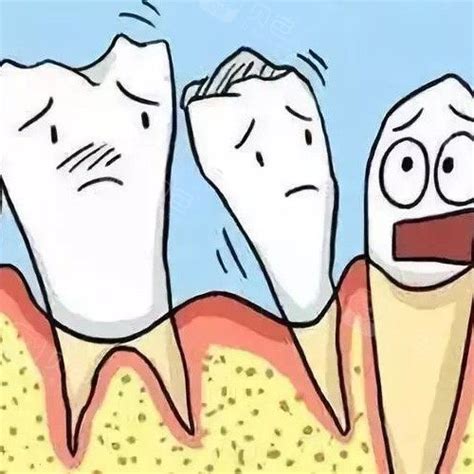 牙齿松动是怎么回事？该怎么办？ 科贸嘉友收录|牙医解答|陕西嘉友科贸有限公司