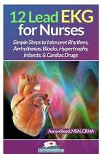 12 Ekg De Derivacion Para Enfermeras: Pasos Simples India | Ubuy