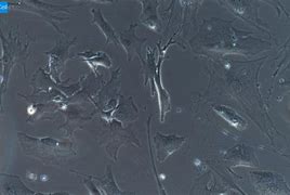 胶质细胞 的图像结果
