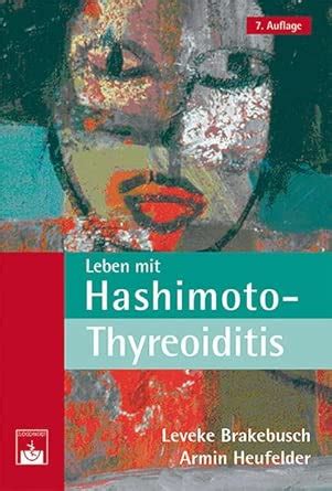 Amazon.in: Buy Leben mit Hashimoto-Thyreoiditis: Ein Ratgeber Book ...