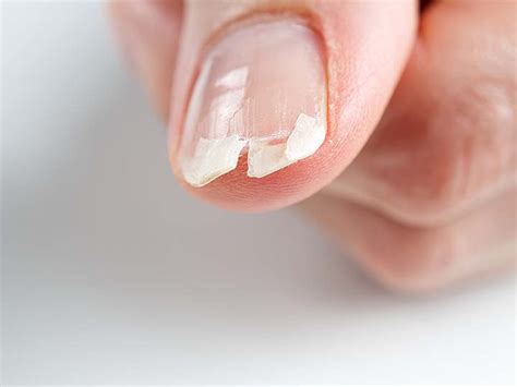 How to Fix Split Nails 的图像结果