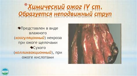 Ожог химический степени фото