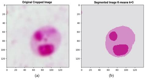 Enhanced Detection of Leishmania Parasites in Microscopic Images Using ...