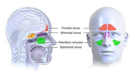 Anatomical Variations Of Paranasal Sinuses at Kenneth Summers blog