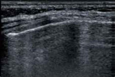 Відкриваємо нові горизонти в ультразвуковій діагностиці - новий світ ...