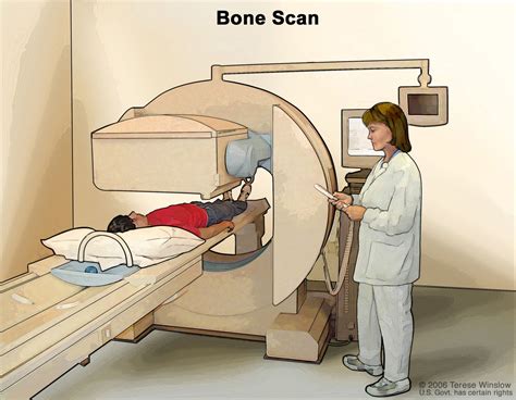 Bone Scan Testing 的图像结果