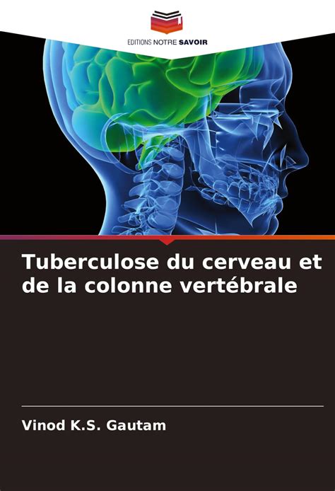 Buy Tuberculose du cerveau et de la colonne vertébrale Book Online at ...