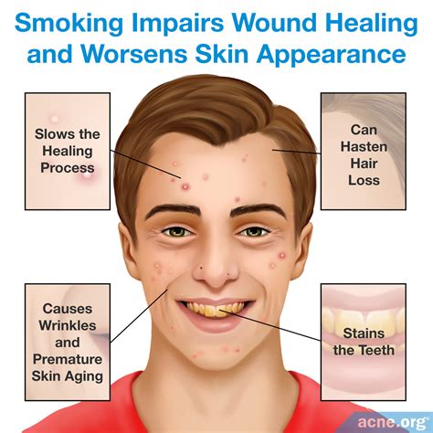Nicotine And Skin