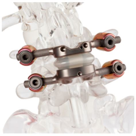 The Future of Motion Preservation and Arthroplasty in the Degenerative ...