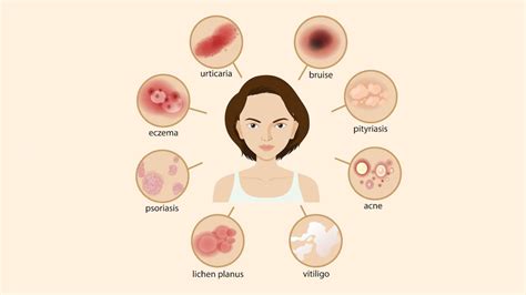 Why Do Skin Tags Develop And How to Remove Them