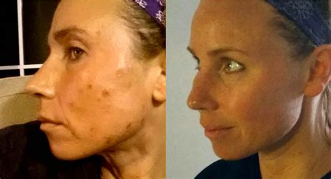 Image result for After Washing Face