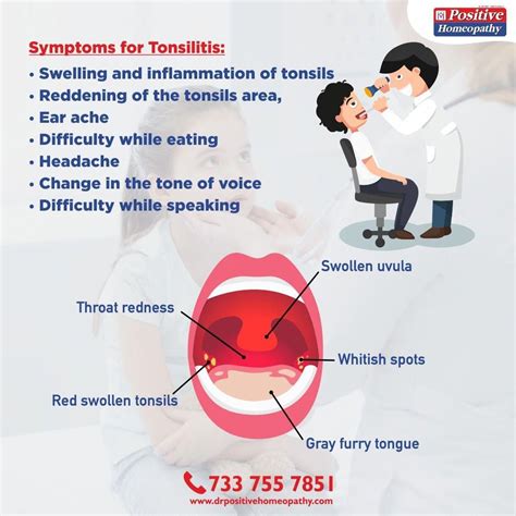 Why Is My Uvula Swollen And Hurting at Darla Jaimes blog
