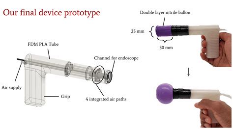 Published! – A Better Way to Visualize the Cervix: a Low-Cost Cervical ...