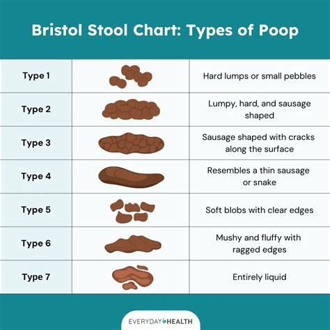 Ibs Stool Shape