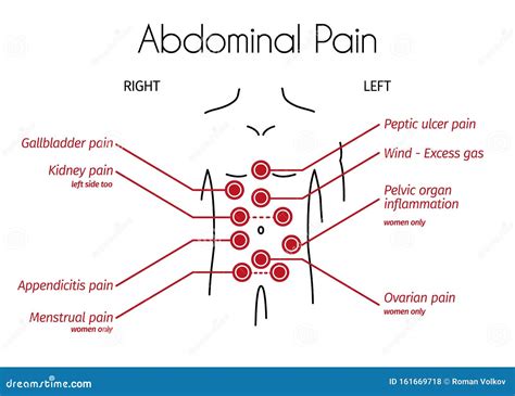 Vector Infographic of Abdominal Pain Types Stock Vector - Illustration ...