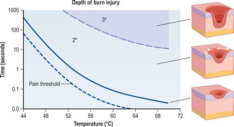 Burn, chemical, and electrical injuries - Clinical Tree