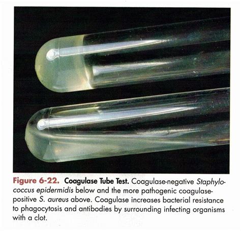 Coagulase Positive Staphylococcus Epidermidis
