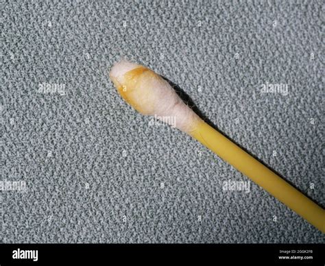 Earwax on a cotton swab, macro photo. Earwax, also known by the medical ...