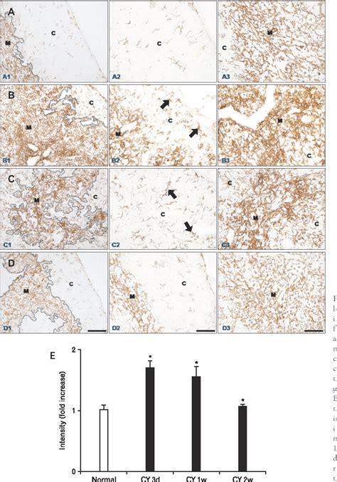 Image result for What Is Thymic Involution