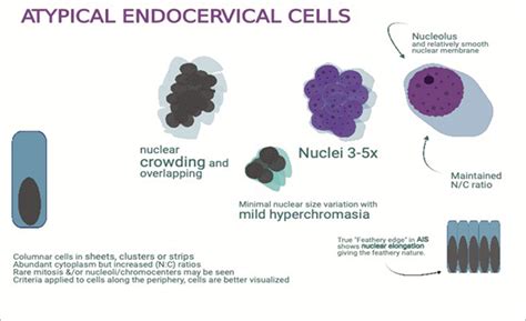 What Is Glandular Atypia at Jonathan Hoffman blog