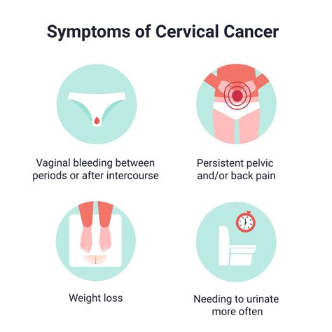 Cervical Cancer Symptoms & Treatment | Aurora Health Care