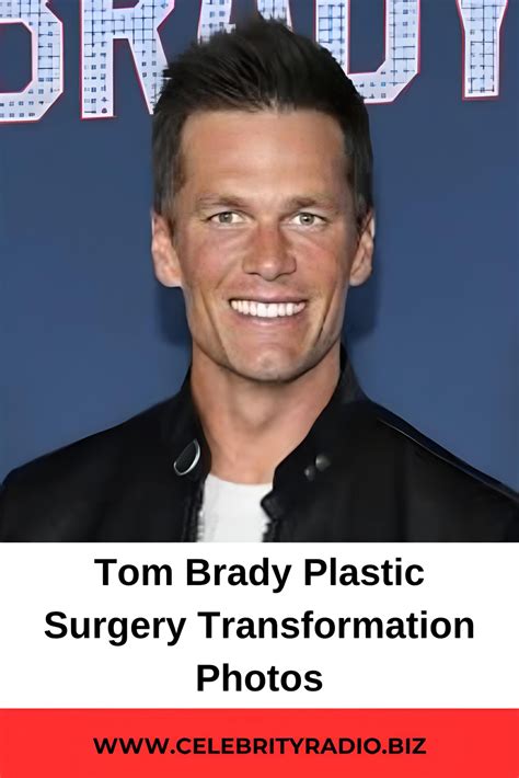 Tom Brady plastic Surgery Transformation Photos | Plastic surgery, Tom brady, Celebrity plastic ...