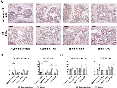 Tranexamic Acid Attenuates the Progression of Posttraumatic ...