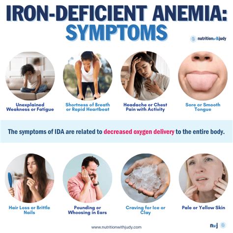 Iron Deficiency Symptoms Stomach Pain at Jeff Span blog