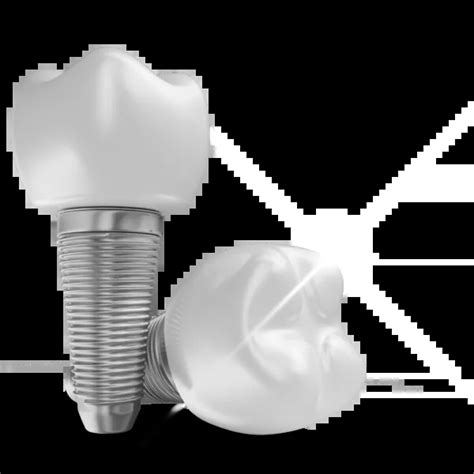 Dental Implants in Albania – 2026 Prices, Procedure & All-Inclusive Care