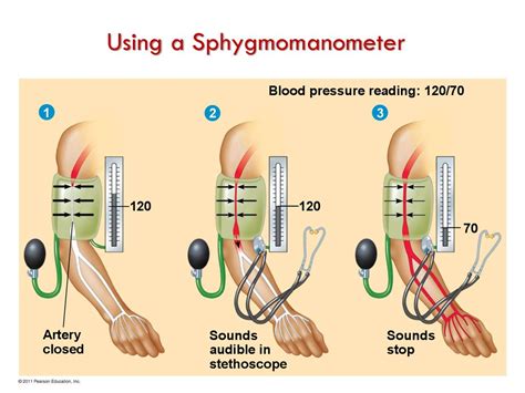 Image result for Using a Sphygmomanometer