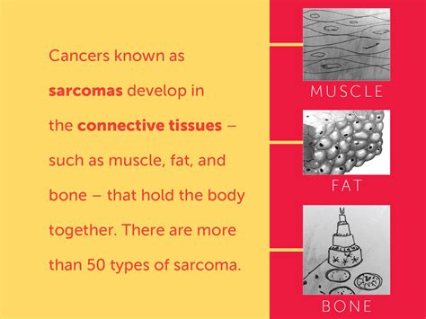 Signs and Symptoms of Soft Tissue Sarcomas | Dana-Farber Cancer Institute
