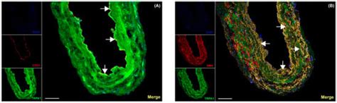Functional Analysis of TRPA1, TRPM3, and TRPV1 Channels in Human Dermal ...