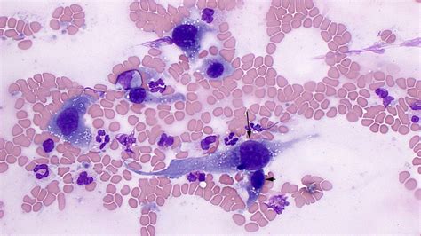 Image result for Hemangiosarcoma