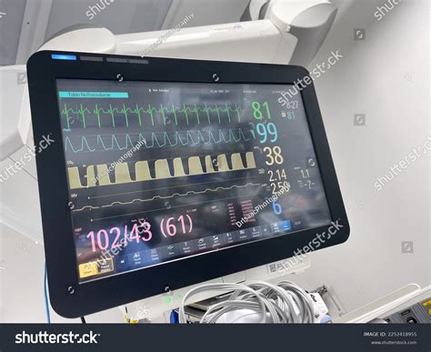 Ecg Monitor Hospital