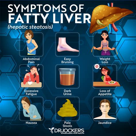 10 Symptoms Of Fatty Liver Disease Facty Health Non Alcoholic Fatty