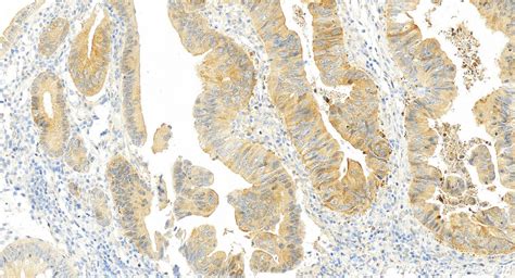HSPH1 antibody (13383-1-AP) | Proteintech