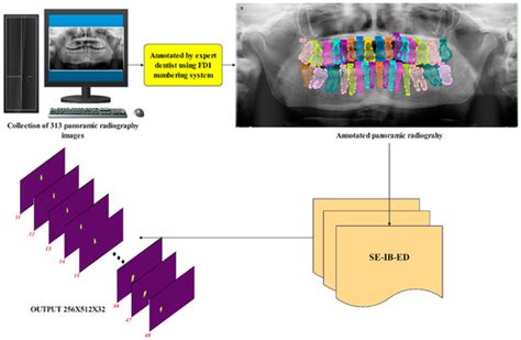 Enhanced Panoramic Radiograph-Based Tooth Segmentation and ...