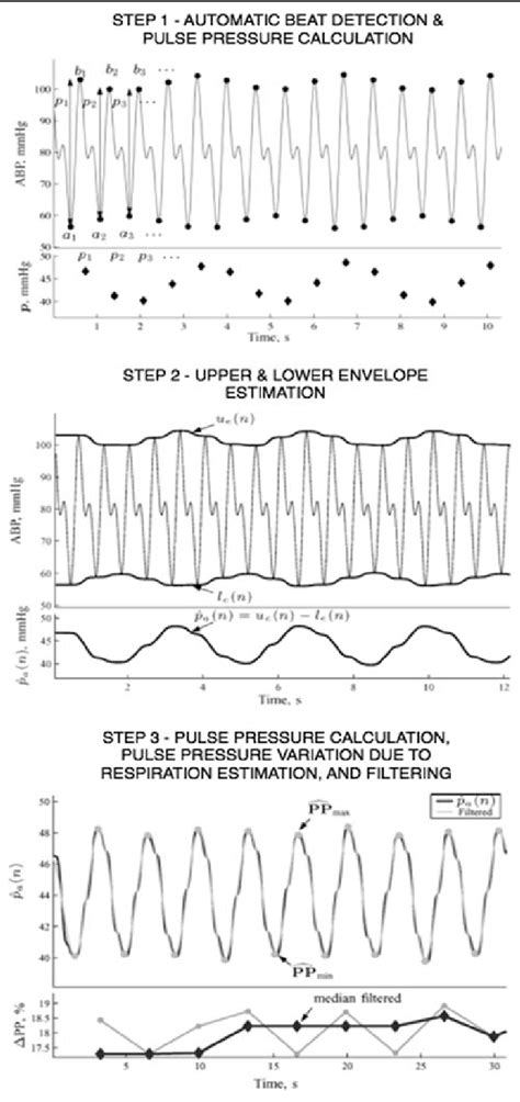 Image result for Pulse Pressure Variation Explained