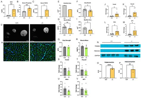Hyperphosphatemia Contributes to Skeletal Muscle Atrophy in Mice